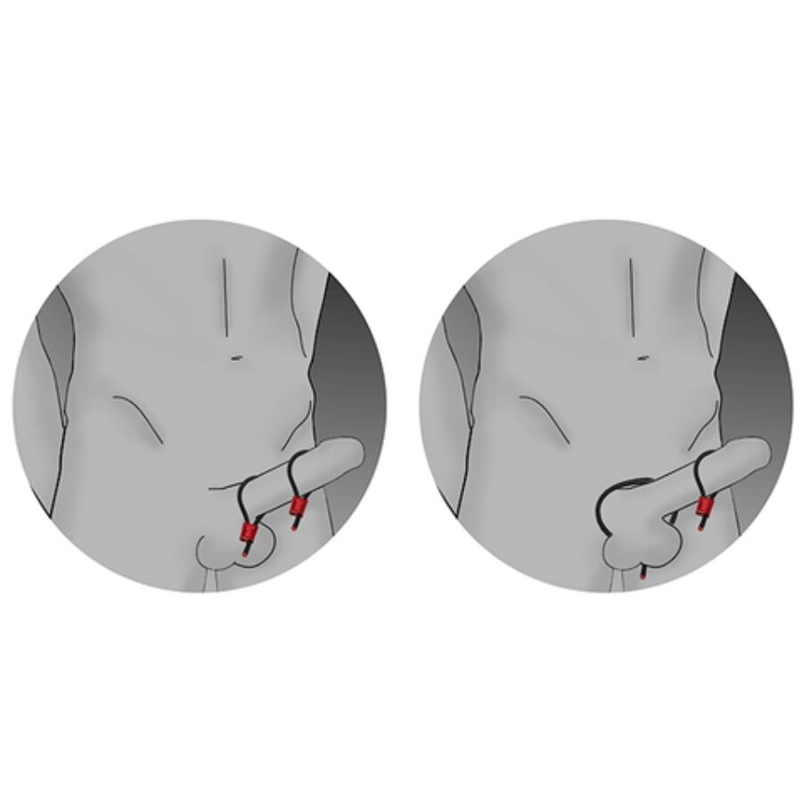 ELECTRASTIM - PRESTIGE ELECTRA LOOPS ADJUSTABLE COCK RINGS RED 3 ELECTRASTIM - PRESTIGE ELECTRA LOOPS ADJUSTABLE COCK RINGS RED - obrazek 3