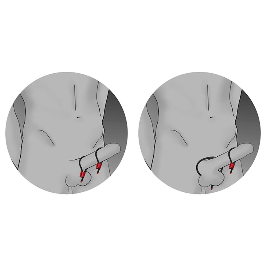 ELECTRASTIM - PRESTIGE ELECTRA LOOPS ADJUSTABLE COCK RINGS BLACK 2 ELECTRASTIM - PRESTIGE ELECTRA LOOPS ADJUSTABLE COCK RINGS BLACK - obrazek 2